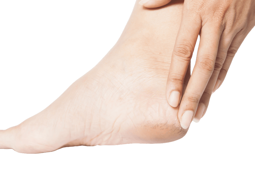 Plantar Faciitis